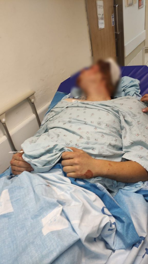 שלושה יהודים נפצעו בהתקפה של פעילי הרש”פ סמוך למעלה עמוס בגוש עציון